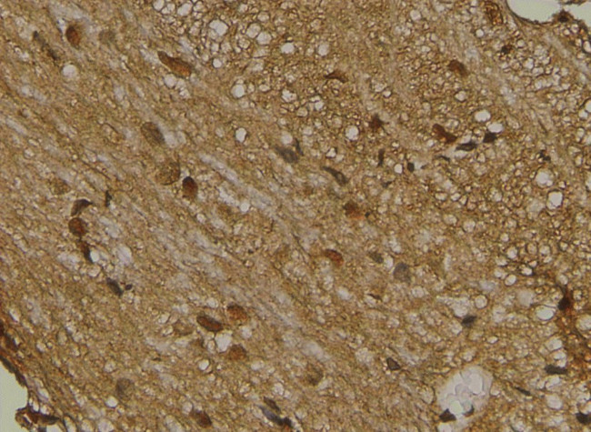 Phospho-Lyn (Tyr193) Antibody in Immunohistochemistry (Paraffin) (IHC (P))