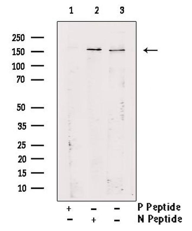 Phospho-PLCG2 (Tyr1245) Antibody in Western Blot (WB)