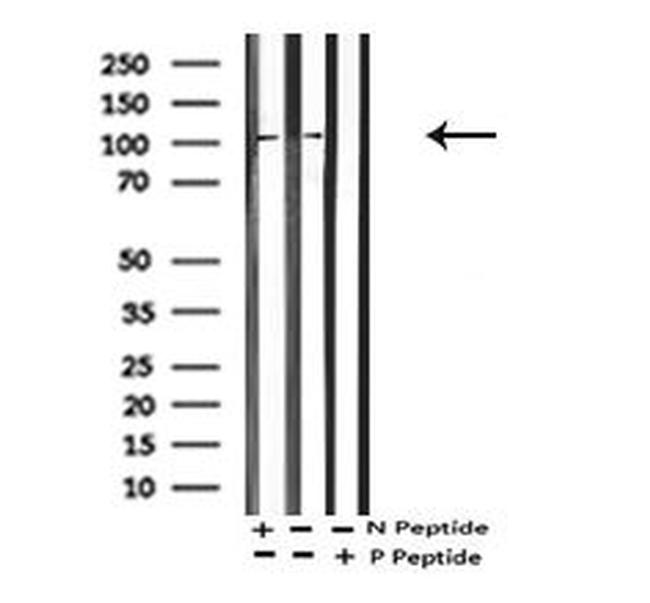 Phospho-EphA2 (Thr587) Antibody in Western Blot (WB)