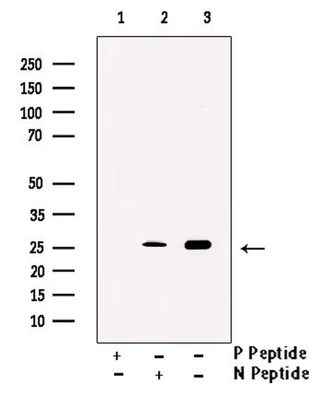 Phospho-Cardiac Troponin I (Ser 23, Ser24) Antibody in Western Blot (WB)