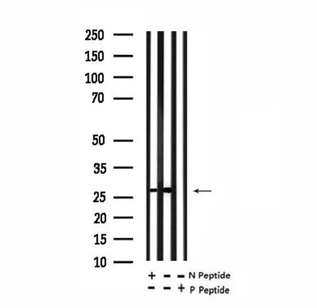 Phospho-Cardiac Troponin I (Ser 23, Ser24) Antibody in Western Blot (WB)