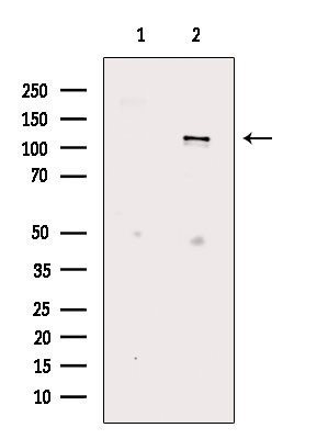 Phospho-EphA7 (Tyr614) Antibody in Western Blot (WB)