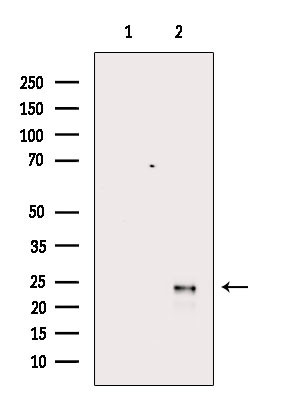 Phospho-NT5C (Ser184) Antibody in Western Blot (WB)