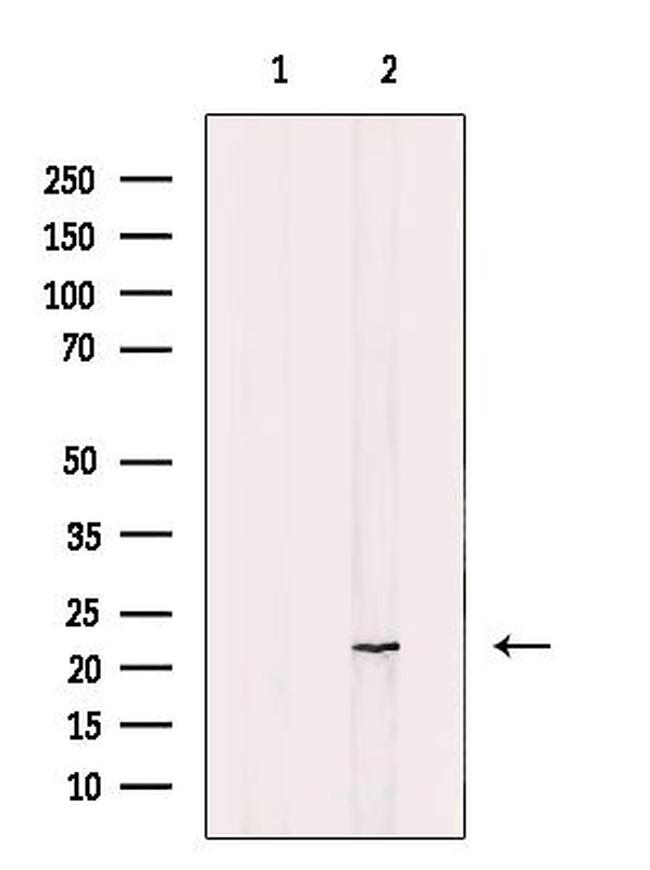 NT5C Antibody in Western Blot (WB)