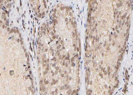 BAP1 Antibody in Immunohistochemistry (Paraffin) (IHC (P))