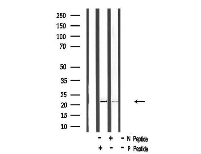 Phospho-HAND1 (Ser98) Antibody in Western Blot (WB)