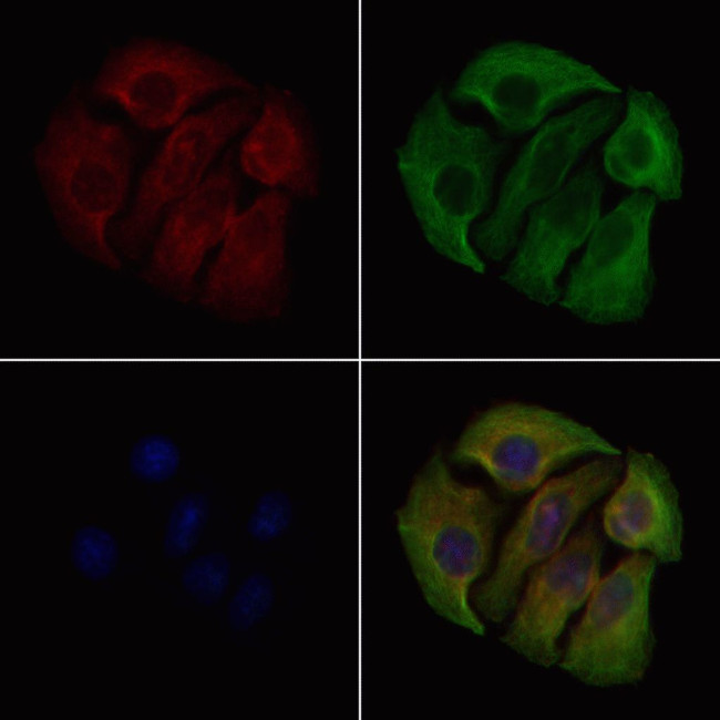 Phospho-Catenin alpha-1 (Ser641) Antibody in Immunocytochemistry (ICC/IF)