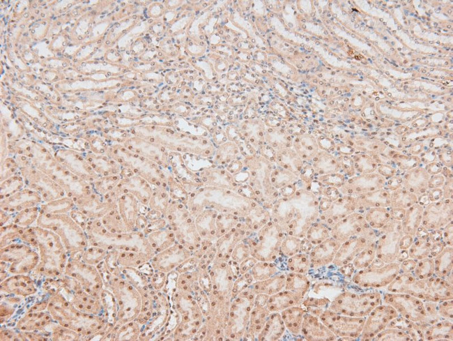 Phospho-Caspase 8 (Tyr448) Antibody in Immunohistochemistry (Paraffin) (IHC (P))