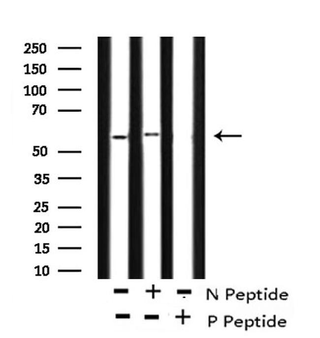 Phospho-Caspase 8 (Tyr448) Antibody in Western Blot (WB)