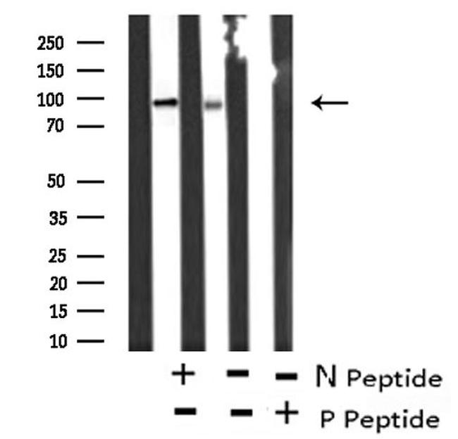 Phospho-FOXO3A (Ser315) Antibody in Western Blot (WB)