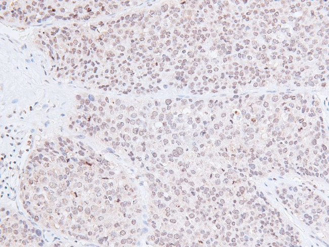 Phospho-PDPK1 (Tyr376) Antibody in Immunohistochemistry (Paraffin) (IHC (P))