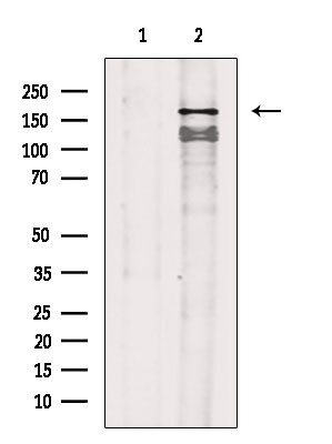 Phospho-VEGF Receptor 1 (Tyr1242) Antibody in Western Blot (WB)