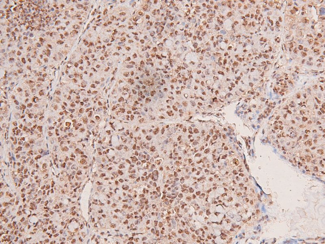 Phospho-FGFR2 (Tyr769) Antibody in Immunohistochemistry (Paraffin) (IHC (P))