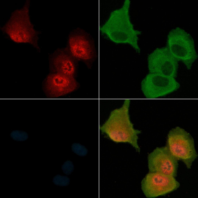 Phospho-MST3 (Thr18) Antibody in Immunocytochemistry (ICC/IF)