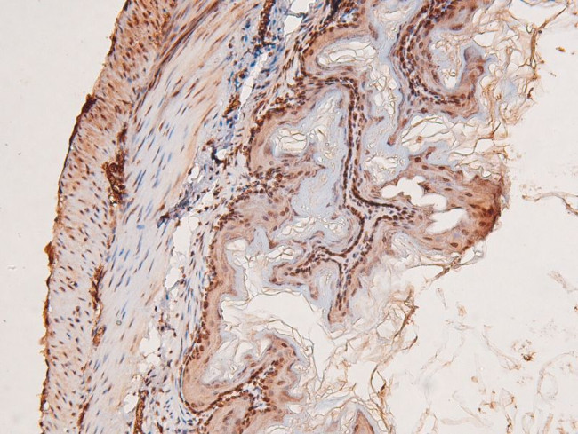 Phospho-MST3 (Thr18) Antibody in Immunohistochemistry (Paraffin) (IHC (P))