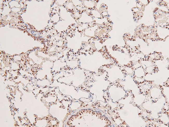 Phospho-MST3 (Thr18) Antibody in Immunohistochemistry (Paraffin) (IHC (P))