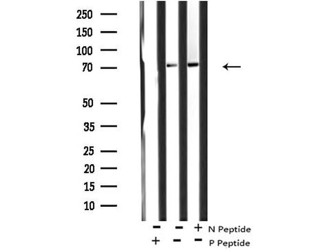 Phospho-ARK5 (Ser600) Antibody in Western Blot (WB)