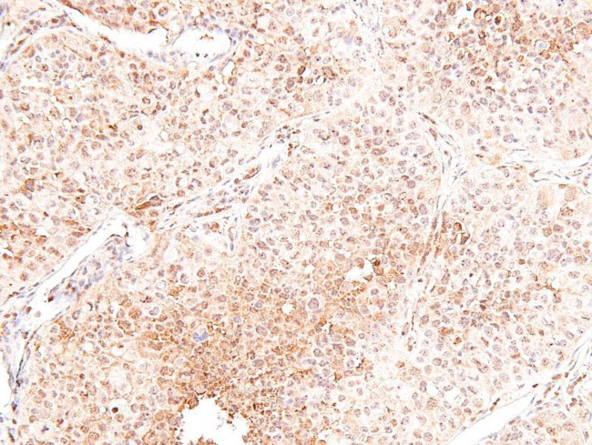 Phospho-ROS1 (Tyr2274) Antibody in Immunohistochemistry (Paraffin) (IHC (P))