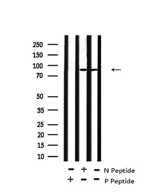Phospho-FGFR Pan (Tyr653, Tyr654) Antibody in Western Blot (WB)