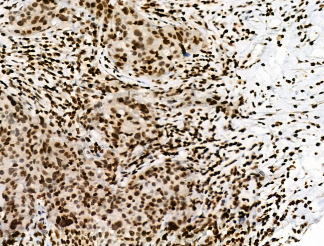 Phospho-RXRA (Ser260) Antibody in Immunohistochemistry (Paraffin) (IHC (P))