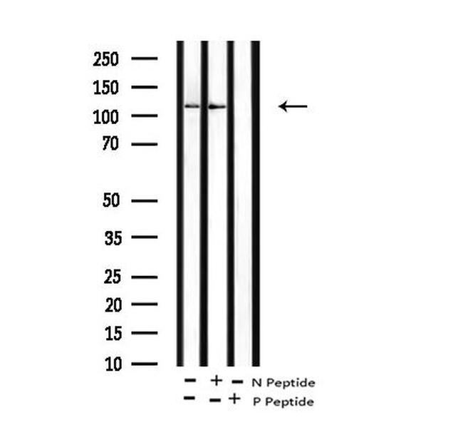 Phospho-EphB1/EphB3/EphB4 (Tyr778, Tyr792, Tyr774) Antibody in Western Blot (WB)