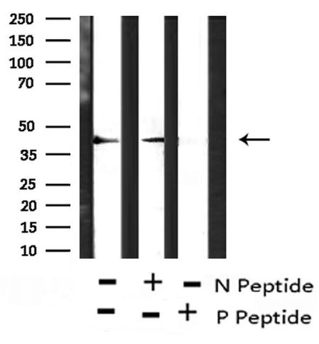 Phospho-Connexin 43 (Ser279) Antibody in Western Blot (WB)