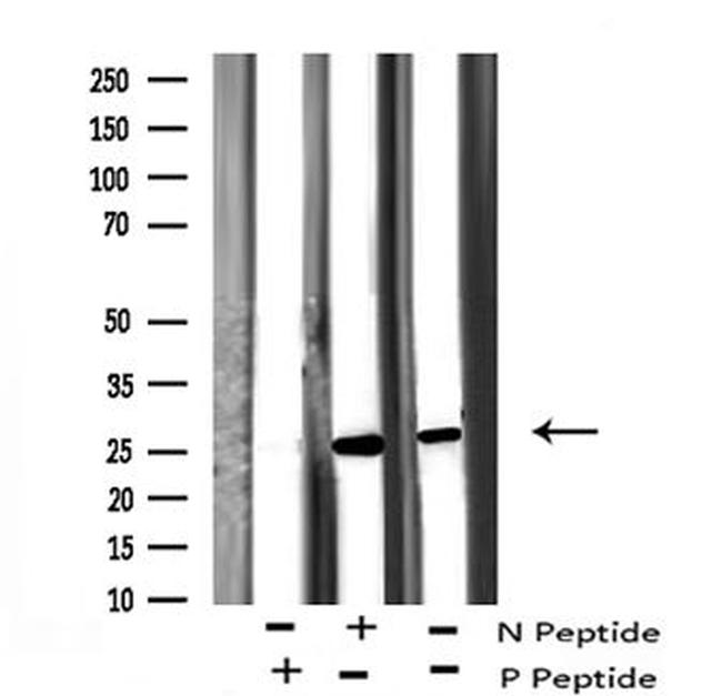 Phospho-Bim (Thr56, Thr116) Antibody in Western Blot (WB)