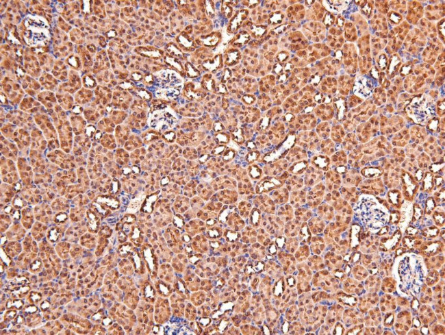 Phospho-CtBP1/CtBP2 (Ser158, Ser164) Antibody in Immunohistochemistry (Paraffin) (IHC (P))