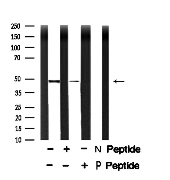 Phospho-CtBP1/CtBP2 (Ser158, Ser164) Antibody in Western Blot (WB)