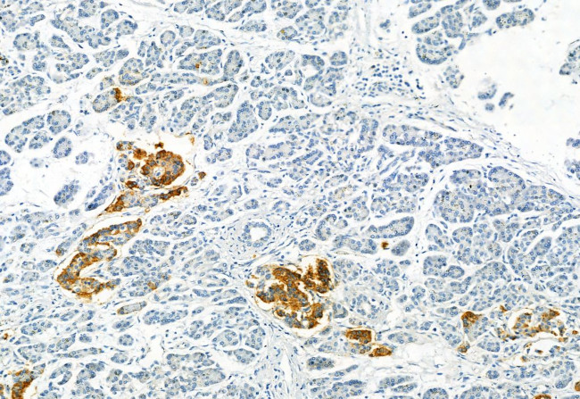 Phospho-SMAD1/SMAD5/SMAD9 (Ser463, Ser465) Antibody in Immunohistochemistry (Paraffin) (IHC (P))