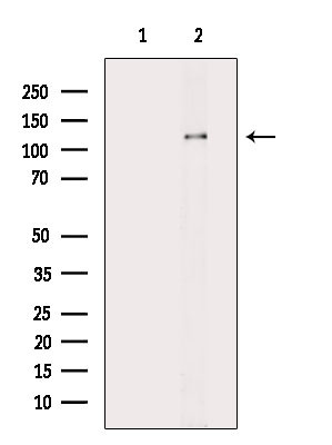 Phospho-ACK1 (Tyr859, Tyr860) Antibody in Western Blot (WB)