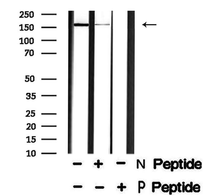 Phospho-LRP6 (Ser1490) Antibody in Western Blot (WB)