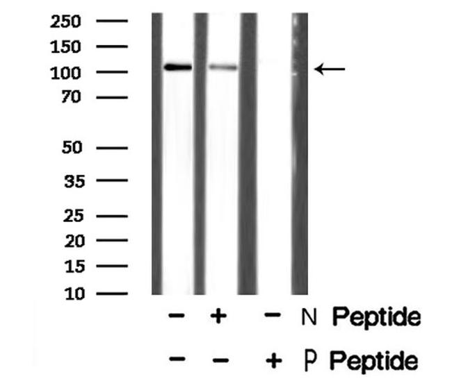 Phospho-EphA3 (Tyr602) Antibody in Western Blot (WB)