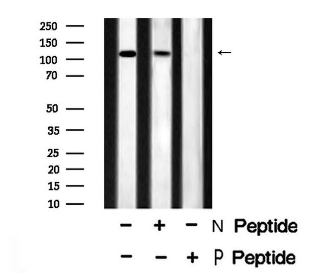 Phospho-EphB1 (Tyr928) Antibody in Western Blot (WB)