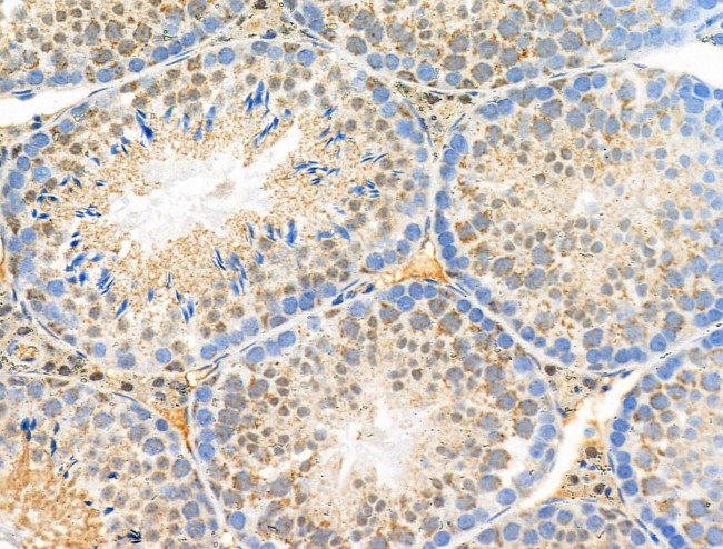 Phospho-FGFR3 (Tyr724) Antibody in Immunohistochemistry (Paraffin) (IHC (P))