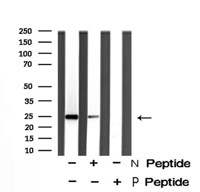 Phospho-HP1 beta (Thr51) Antibody in Western Blot (WB)