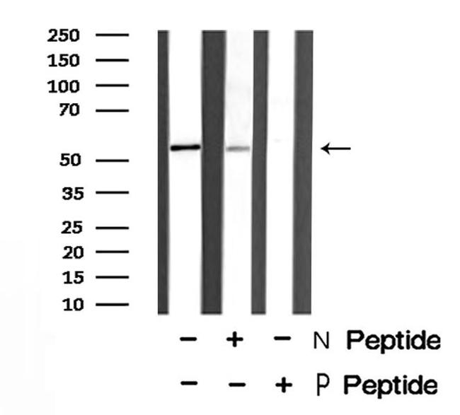 Phospho-IRF7 (Ser477) Antibody in Western Blot (WB)