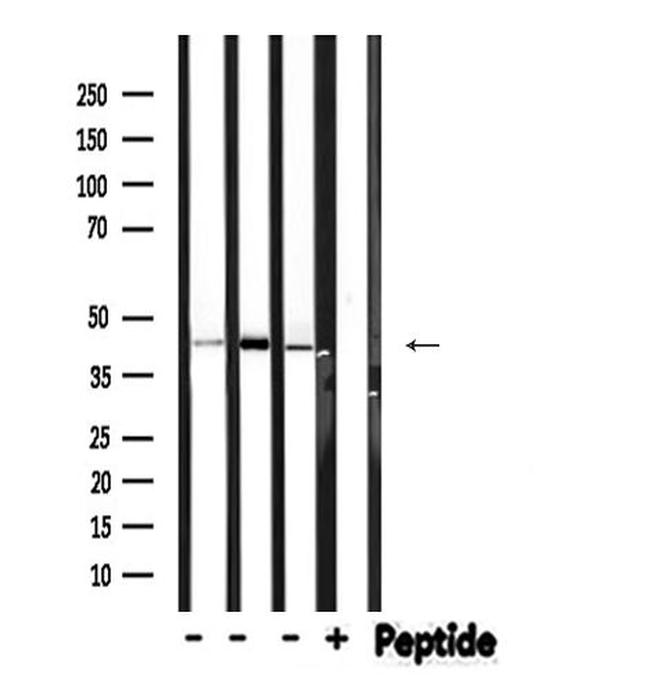 Phospho-HPD (Thr382) Antibody in Western Blot (WB)