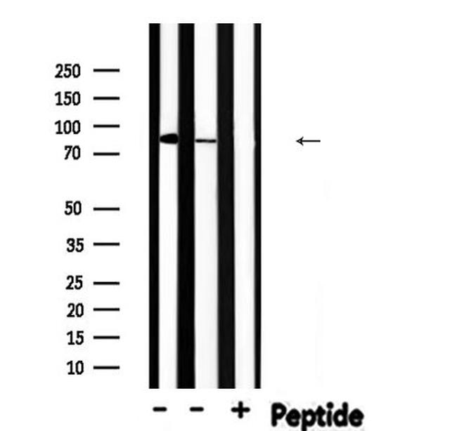 Phospho-PFKP (Tyr52) Antibody in Western Blot (WB)