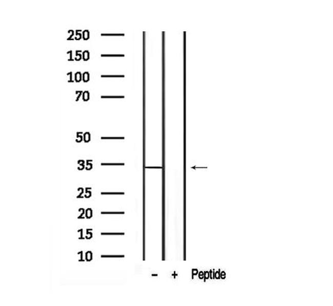 Phospho-KHK isoform A (Ser80) Antibody in Western Blot (WB)