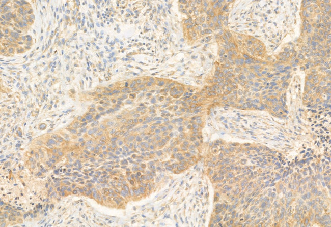 REEP5 Antibody in Immunohistochemistry (Paraffin) (IHC (P))