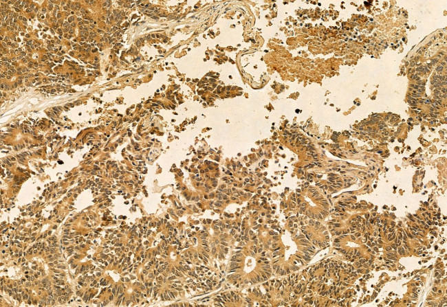 QSOX1 Antibody in Immunohistochemistry (Paraffin) (IHC (P))