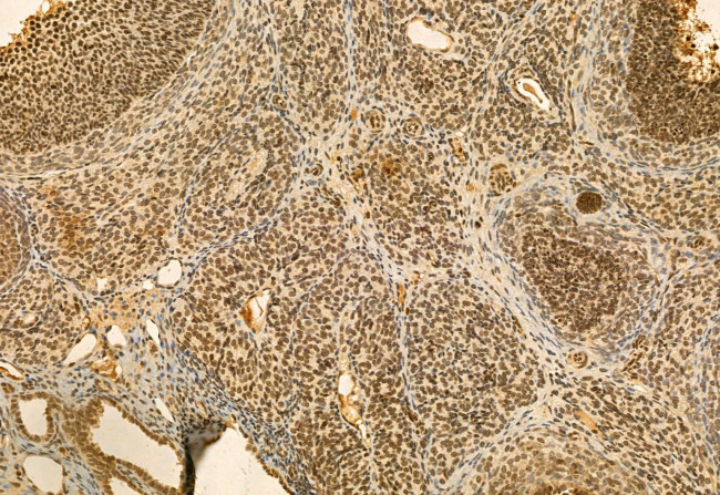 QSOX1 Antibody in Immunohistochemistry (Paraffin) (IHC (P))