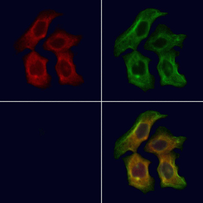 PEX16 Antibody in Immunocytochemistry (ICC/IF)