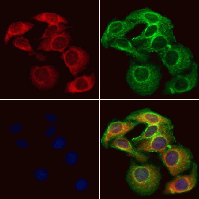 MTHFD2 Antibody in Immunocytochemistry (ICC/IF)