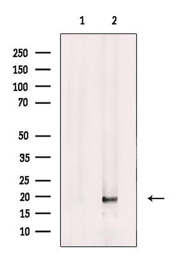FAM96B Antibody in Western Blot (WB)