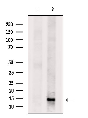 DNAJC19 Antibody in Western Blot (WB)