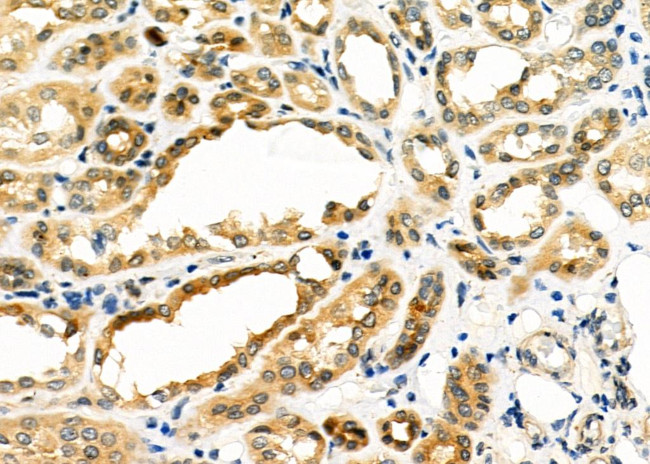 PDHB Antibody in Immunohistochemistry (Paraffin) (IHC (P))