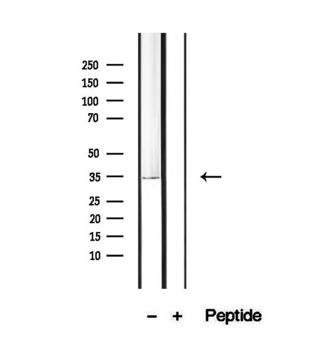 PDHB Antibody in Western Blot (WB)