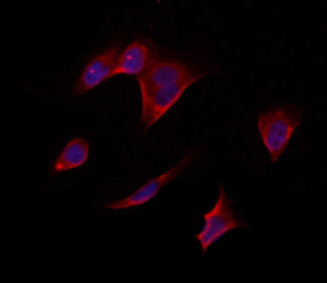 RPS14 Antibody in Immunocytochemistry (ICC/IF)